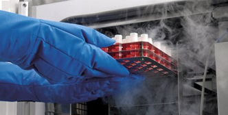 تطبيق درجة حرارة منخفضة الفريزر in البحوث الطبية الحيوية والتخزين